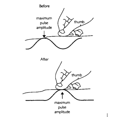 acr-pulse